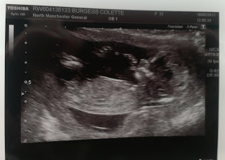 12 week scan photo (Baby measured at 13 + 4)