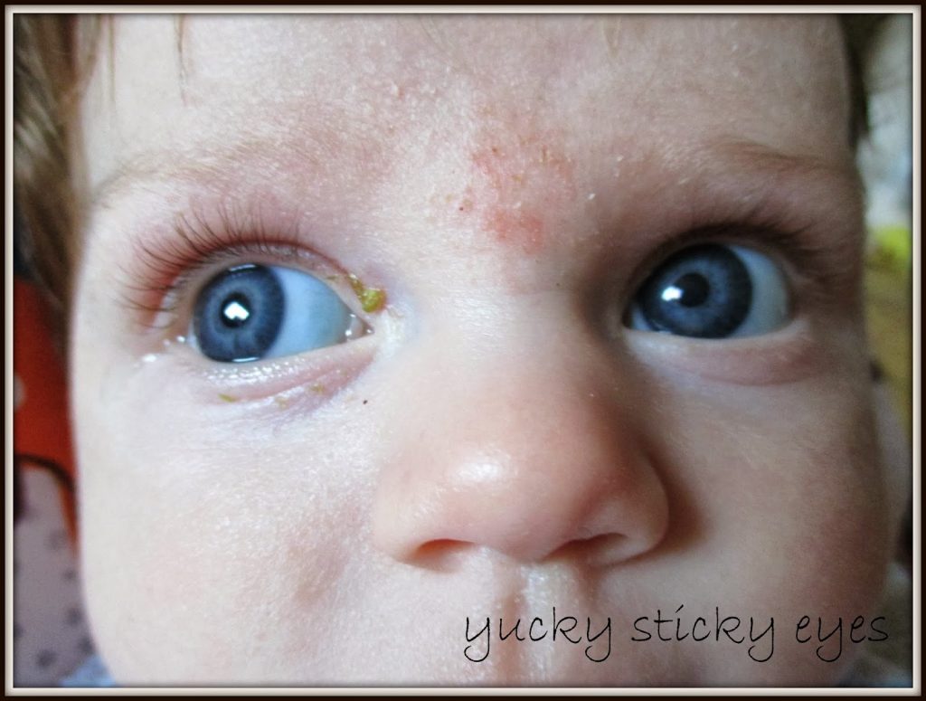 Before using the Dentinox Eye Wipes