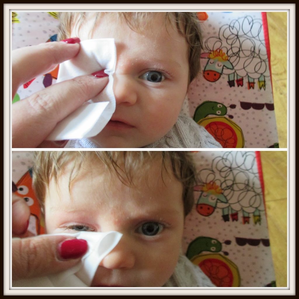 How to use Dentinox Eye Wipes