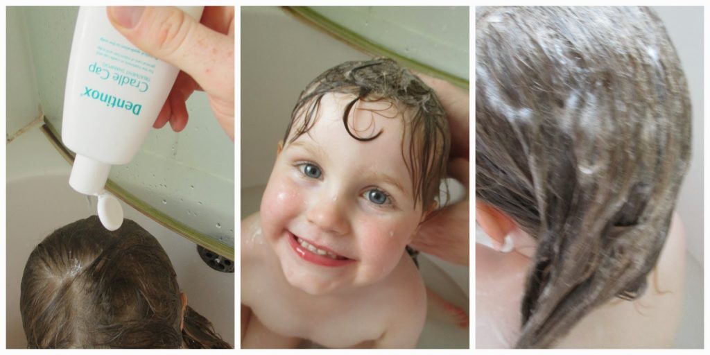Dentinox Cradle Cap Shampoo