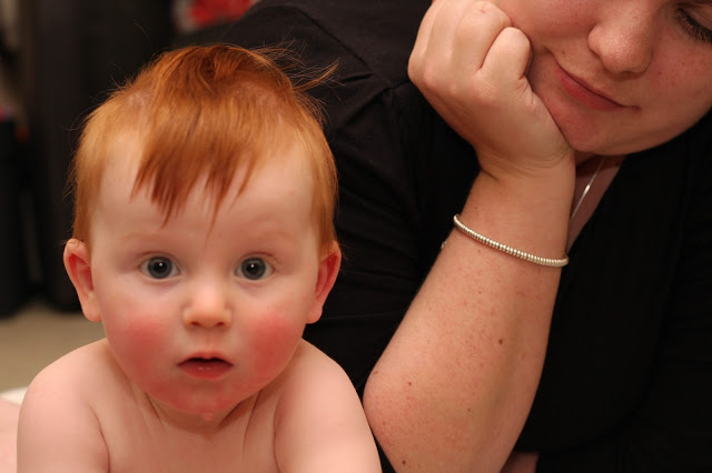 teething baby with classic rosy cheeks and dribble