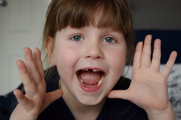 My little girl lost her first tooth